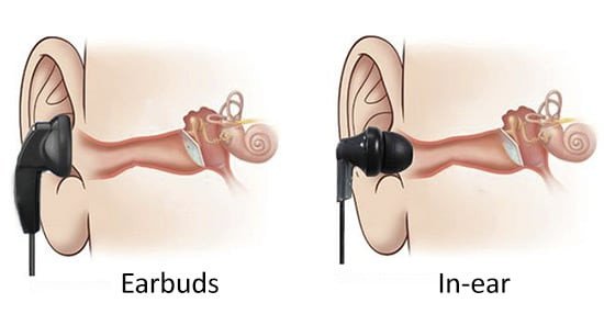 So sánh thiết kế tai nghe in-ear và earbuds