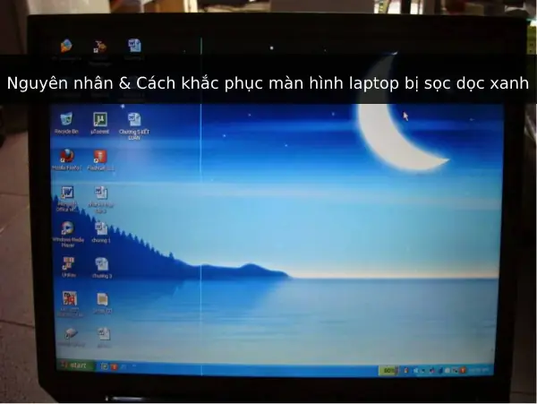 Nguyên Nhân & Cách Khắc Phục Màn Hình Laptop Bị Sọc Dọc Xanh