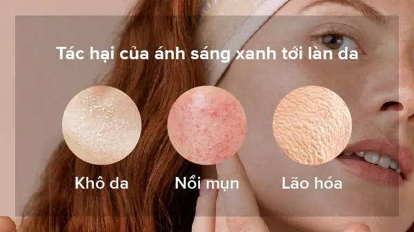 Ánh Sáng Màn Hình Máy Tính Có Hại Da Không?