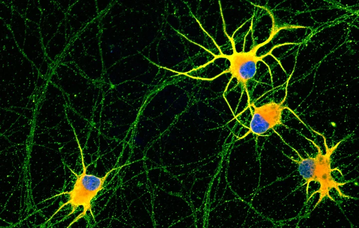 Loại tế bào nào chịu trách nhiệm truyền tải tín hiệu trong cơ thể? Minh họa cách neuron truyền tín hiệu qua synapse
